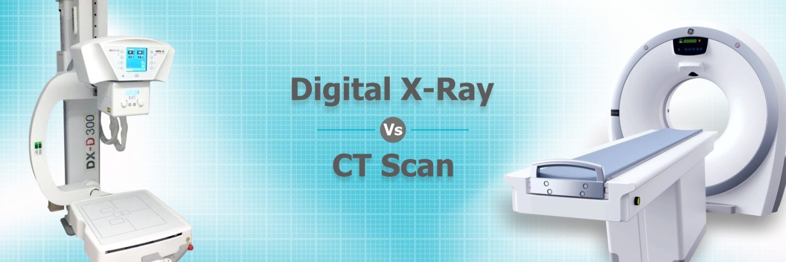 X-ray vs CT Scan: Differences, Pros and Cons