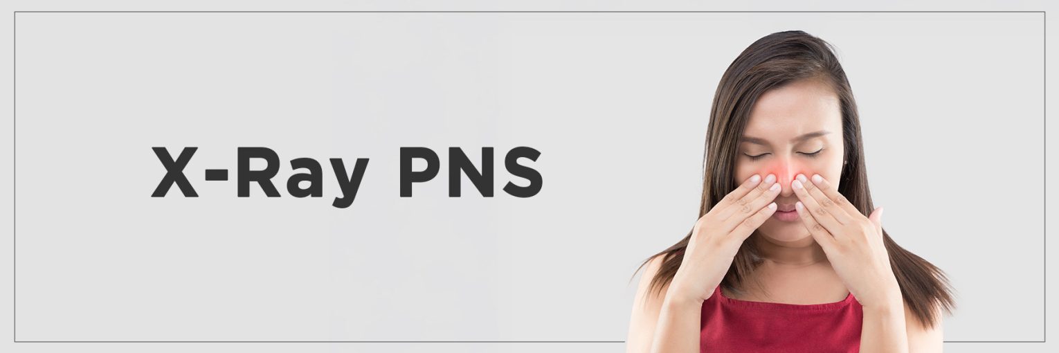 X-ray PNS test