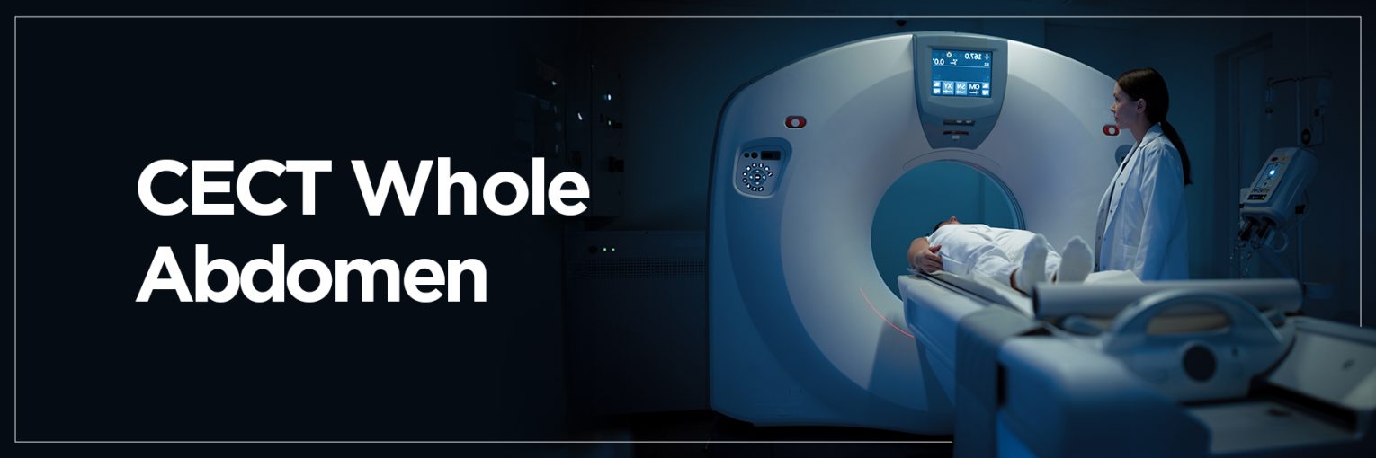 CECT Whole Abdomen Scan – A Complete Guide to Uses, Risks & Benefits