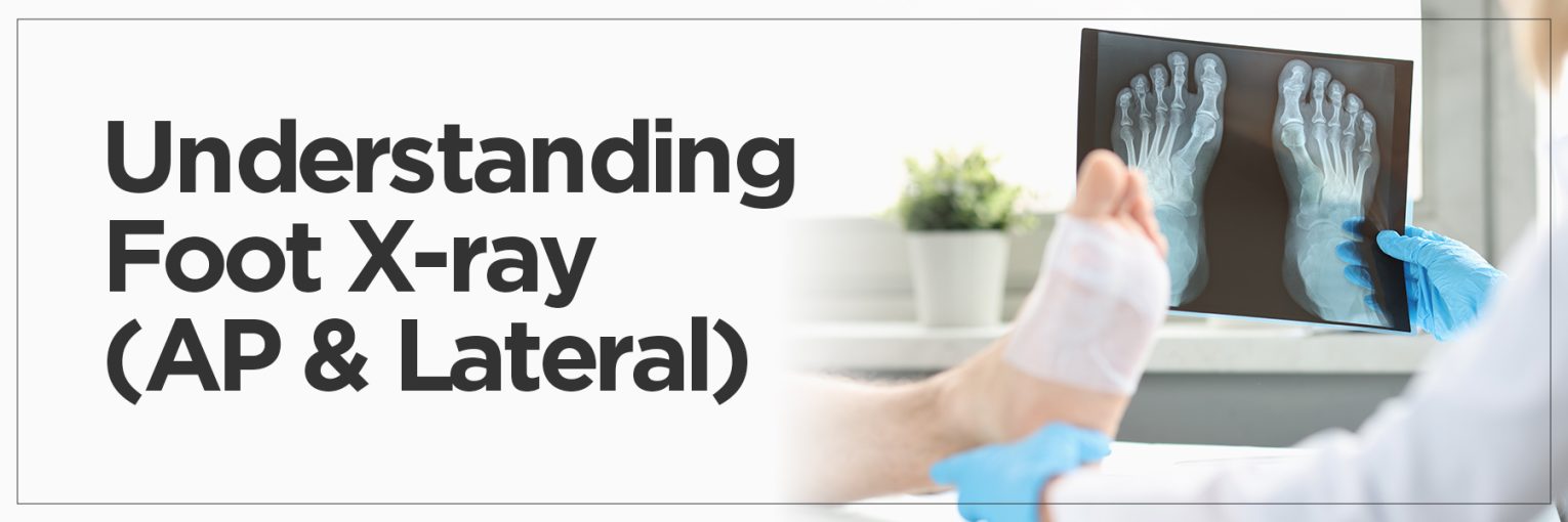 Understanding Foot X-ray (AP & Lateral)