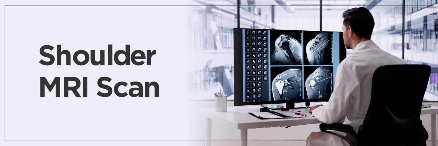 Shoulder MRI Scan: Diagnosis, Safety, and Cost Factors Explained