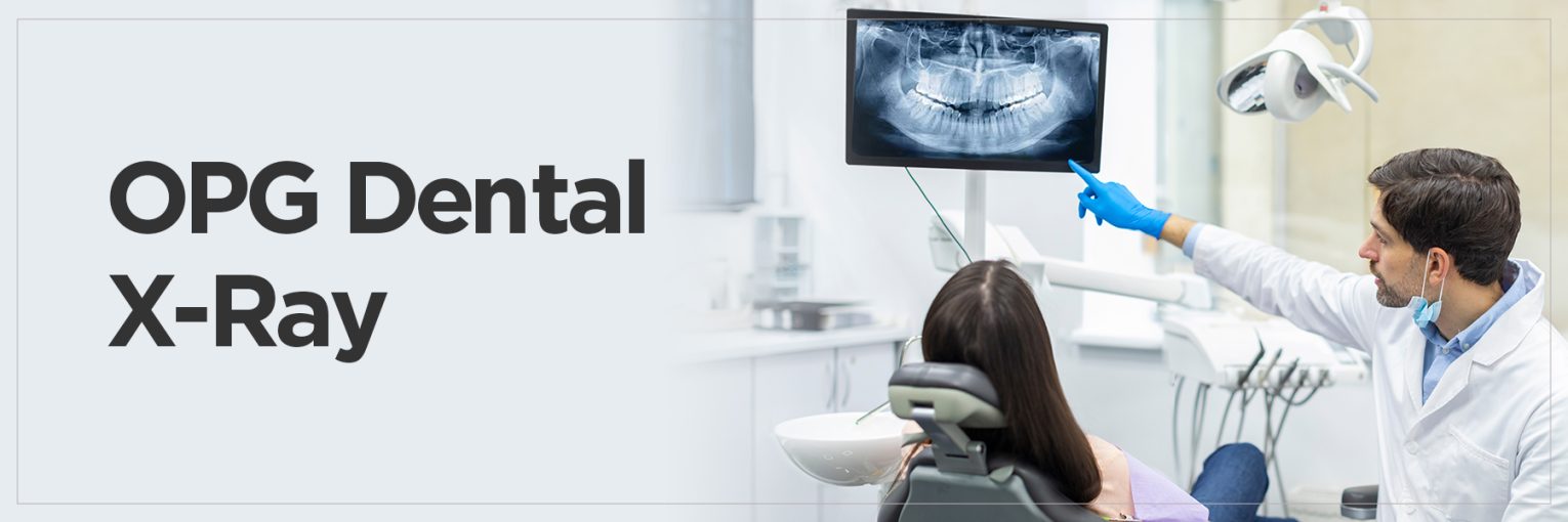 OPG Dental X-Ray: What It Is & Why You Need It