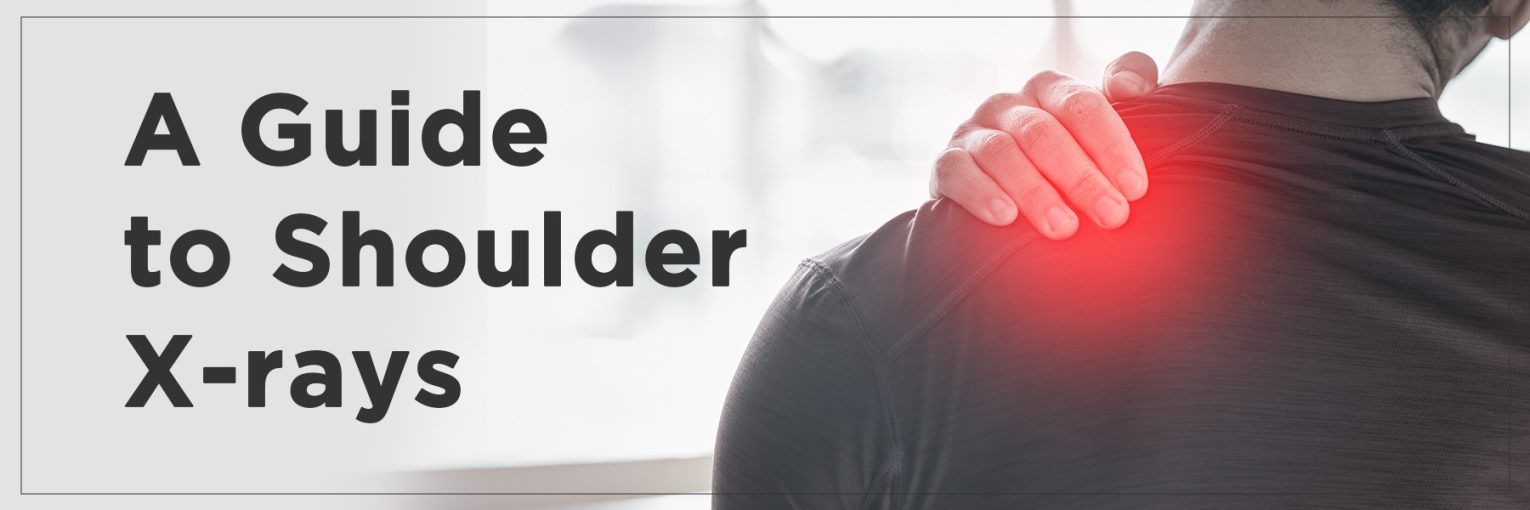 A Guide to Shoulder X-rays