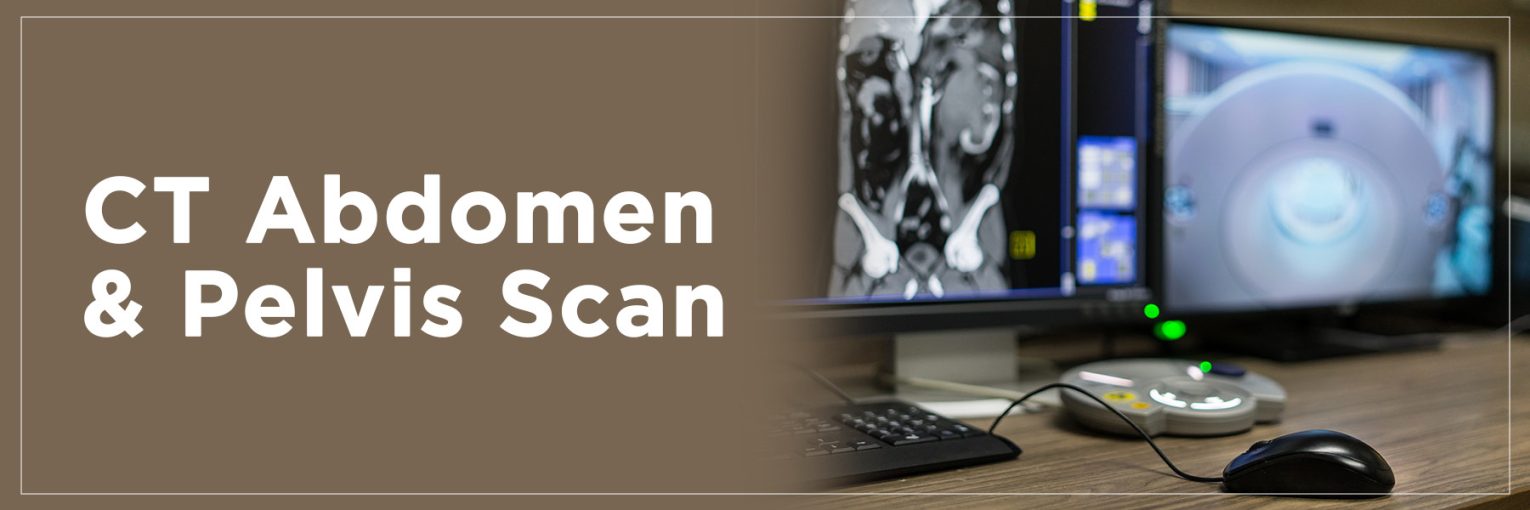 CT Abdomen & Pelvis Scan