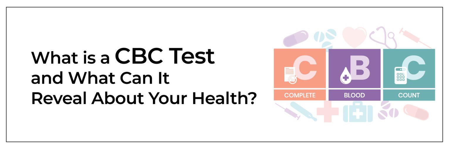 CBC Test Explained: What It Measures and Why It’s Essential