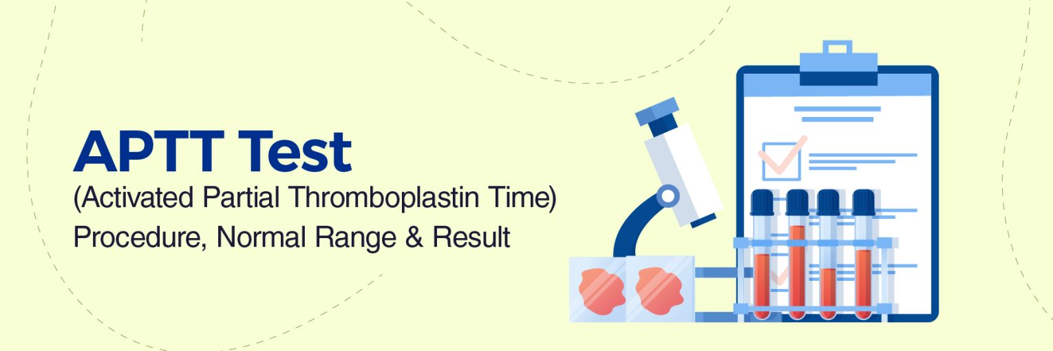 APTT Test (Activated Partial Thromboplastin Time): Know the Procedure, Normal Range and Results to Expect