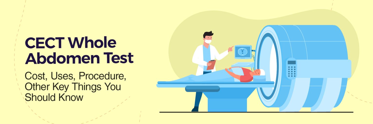CECT Whole Abdomen Test Cost, Uses, Procedure, Other Key Things You Should Know