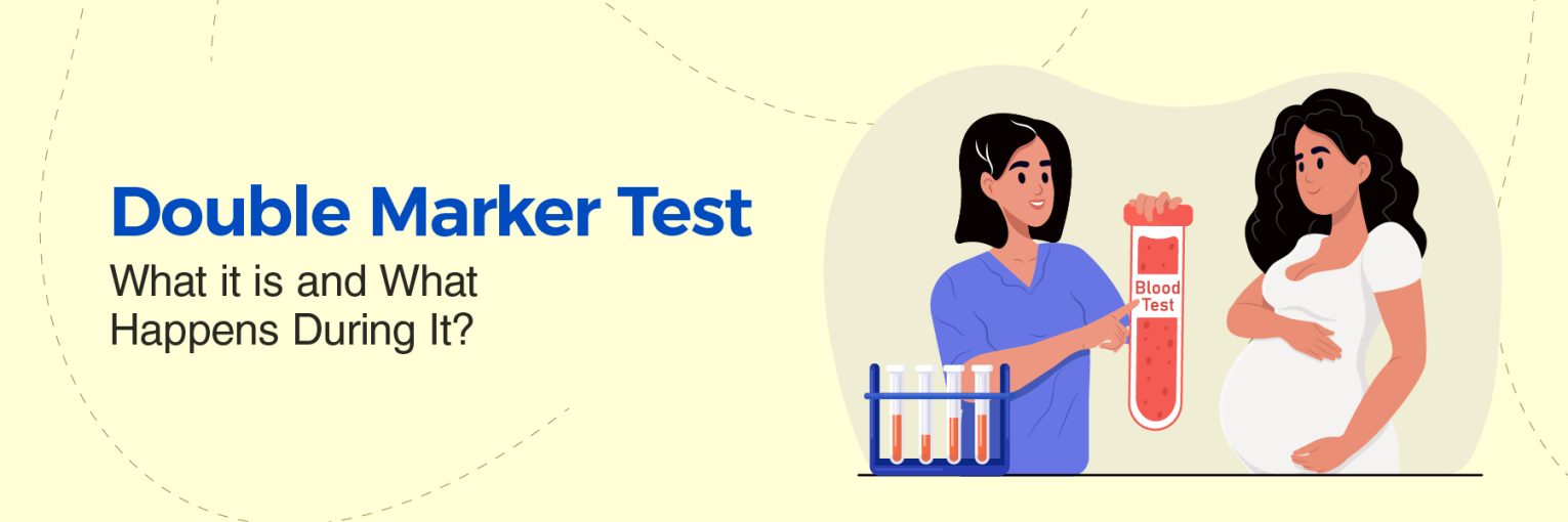 Double Marker Test: What It Is, Procedure, Results and Importance During Pregnancy