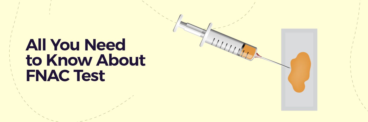 All You Need to Know About FNAC Test: Meaning, Procedure, Results and Importance in Diagnosis