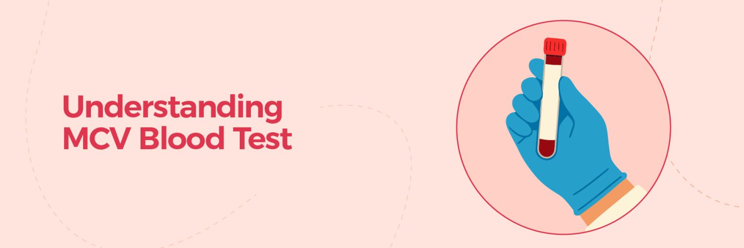 Understanding the MCV Blood Test Parameter