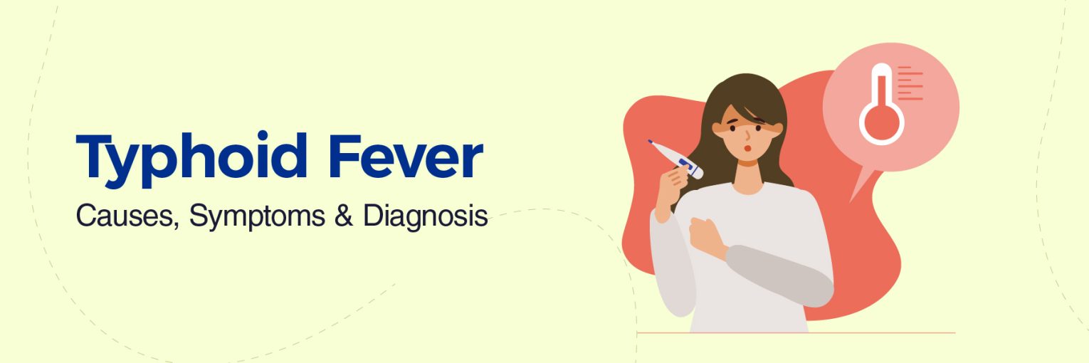 Typhoid Fever: Causes, Symptoms and Diagnosis