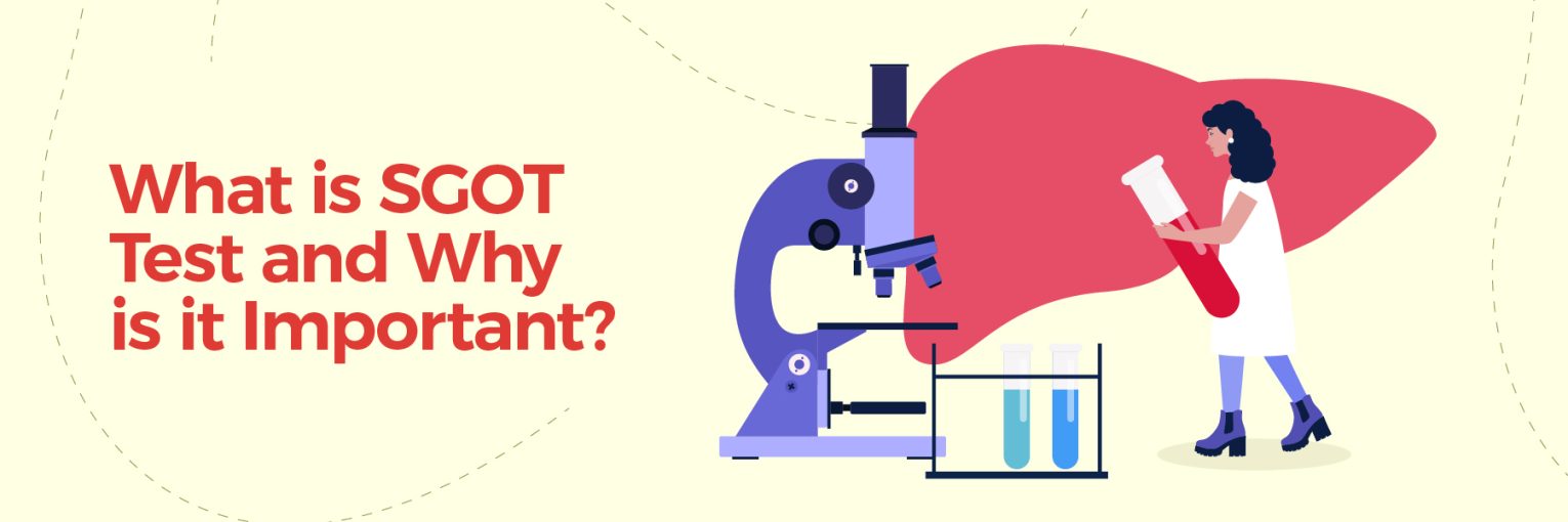 Learn What is SGOT Test, Its Procedure, Normal Range and Importance