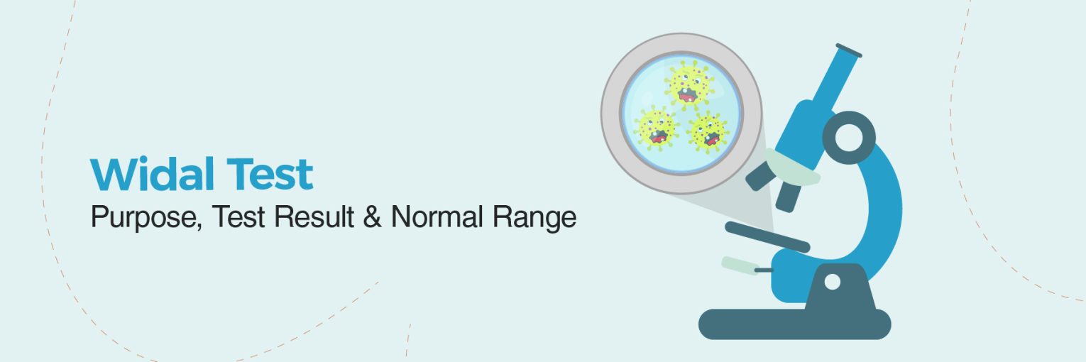 Widal Test: Purpose, Test Result & Normal Range