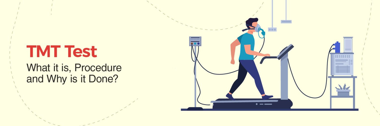 TMT Test: What It Is, Procedure, and Why It Is Done?